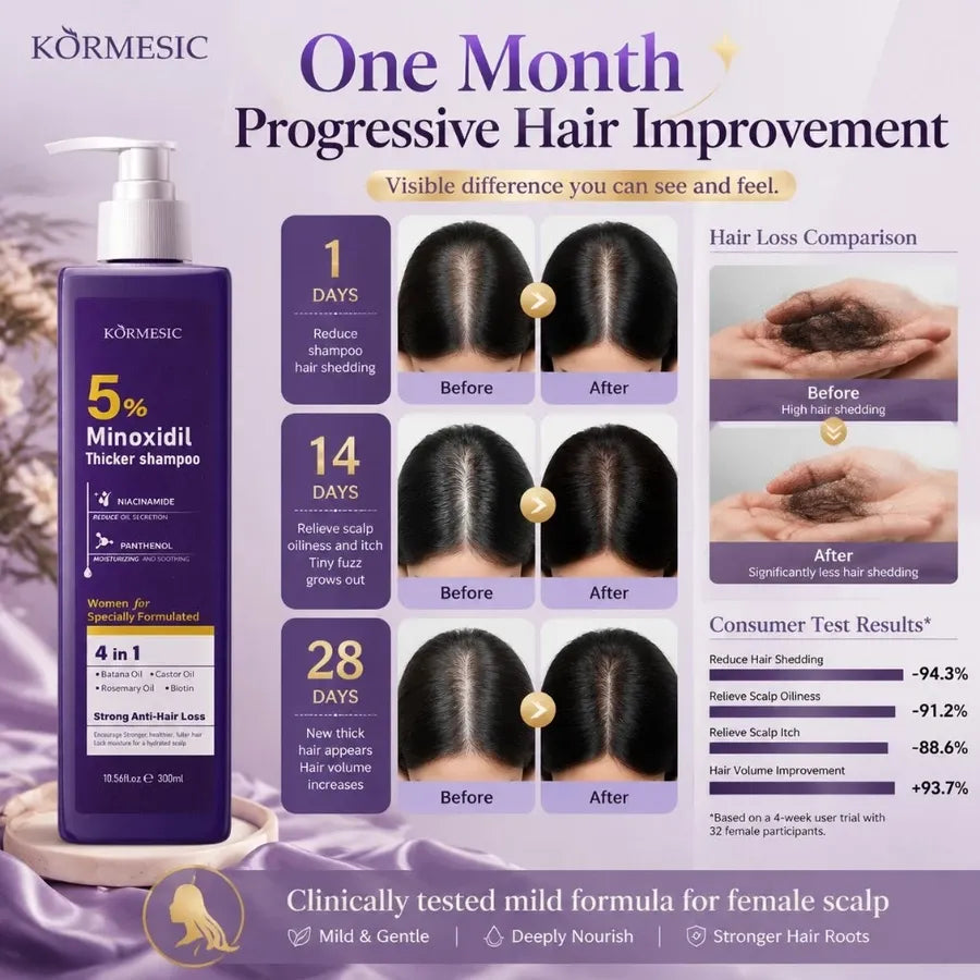 Kormesic 5% Minoxidil Thicker Shampoo for Women 300ml