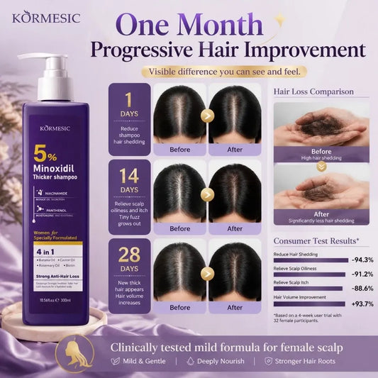 Kormesic 5% Minoxidil Thicker Shampoo for Women 300ml