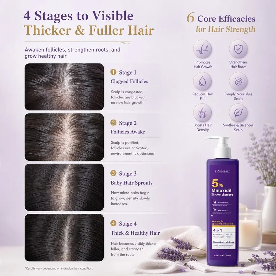 Kormesic 5% Minoxidil Thicker Shampoo for Women 300ml