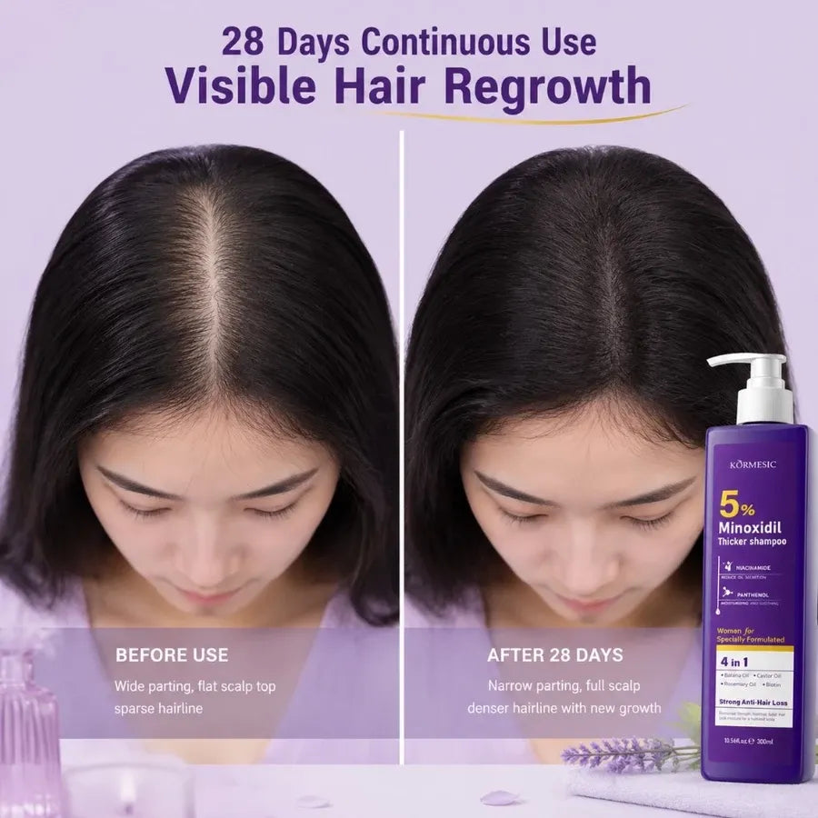 Kormesic 5% Minoxidil Thicker Shampoo for Women 300ml