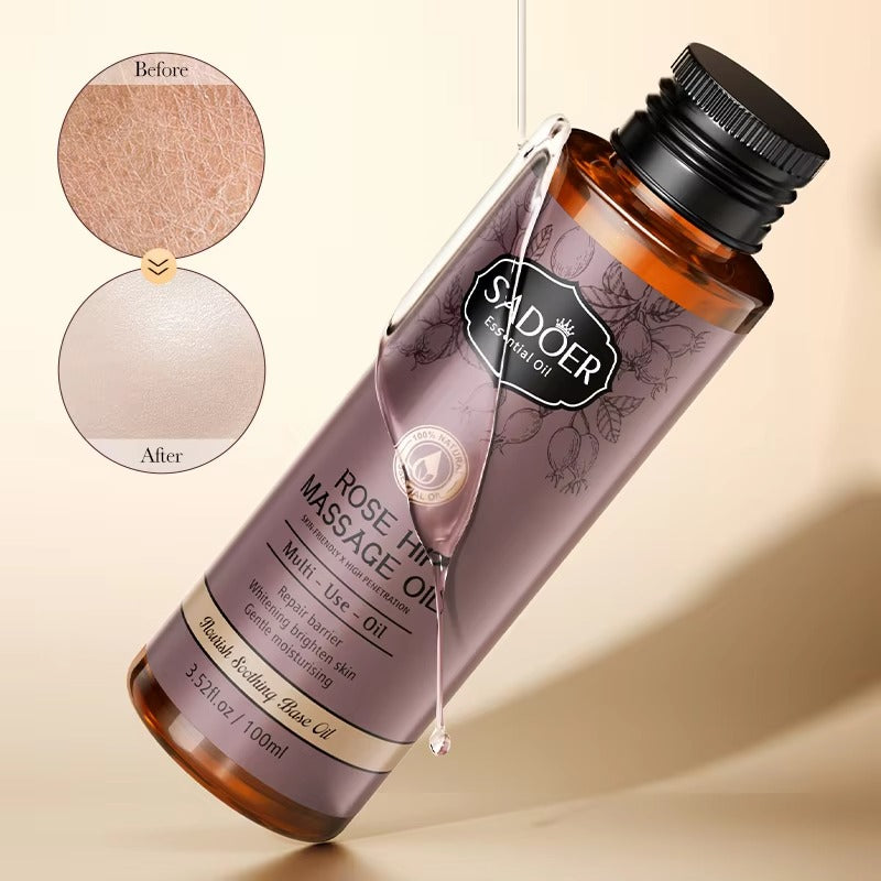Bottle of Sadoer Rose Hip Massage Oil with 'Before' and 'After' skin texture comparison on a beige background.