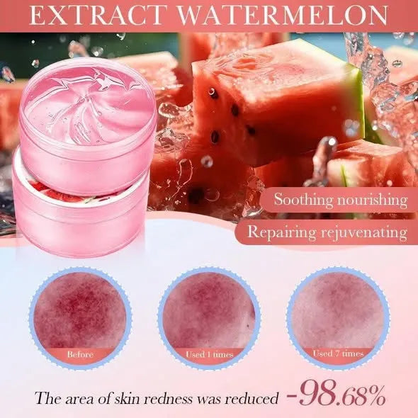 Pink cosmetic gel in a round jar shown on a promotional graphic with watermelon slices, Chinese text, and before/after skin redness circles.