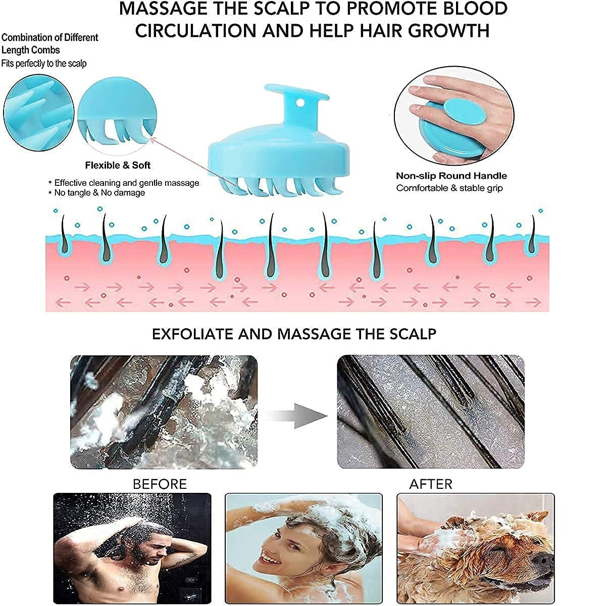 Silicone Scalp Massager Brush – Shampoo Scrubber for Hair Growth & Deep Cleanse