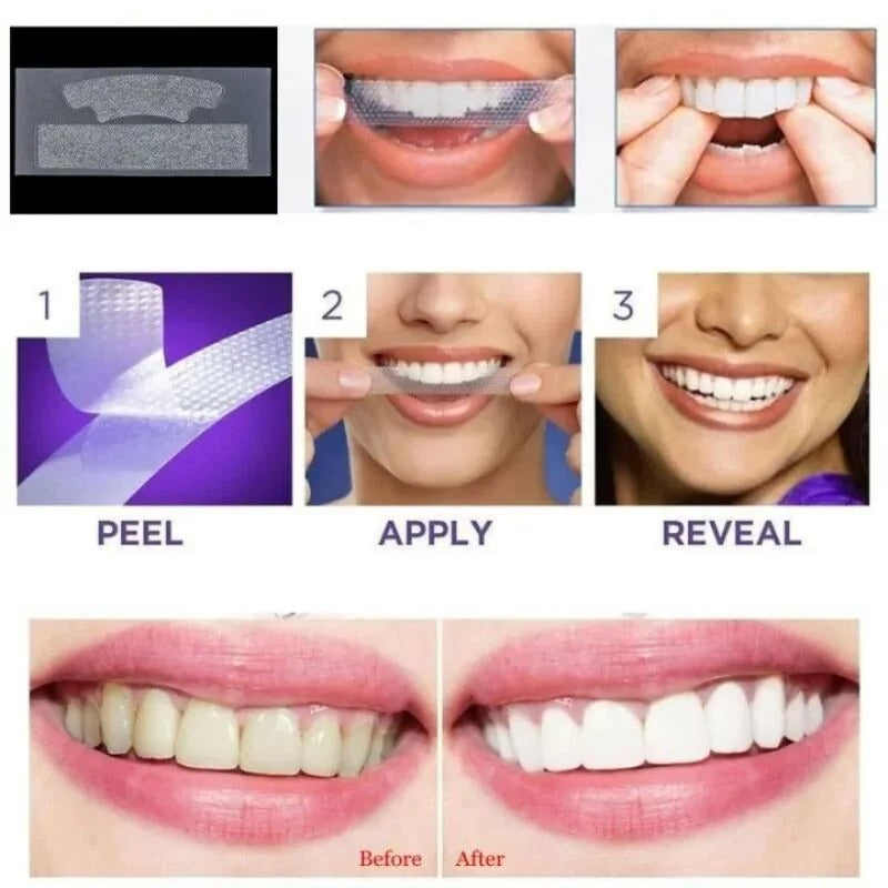 A collage demonstrating a teeth-whitening or bonding strip product, showing the material close-up, peeling and applying the strip, revealing white teeth, and a before-and-after comparison of smile results.